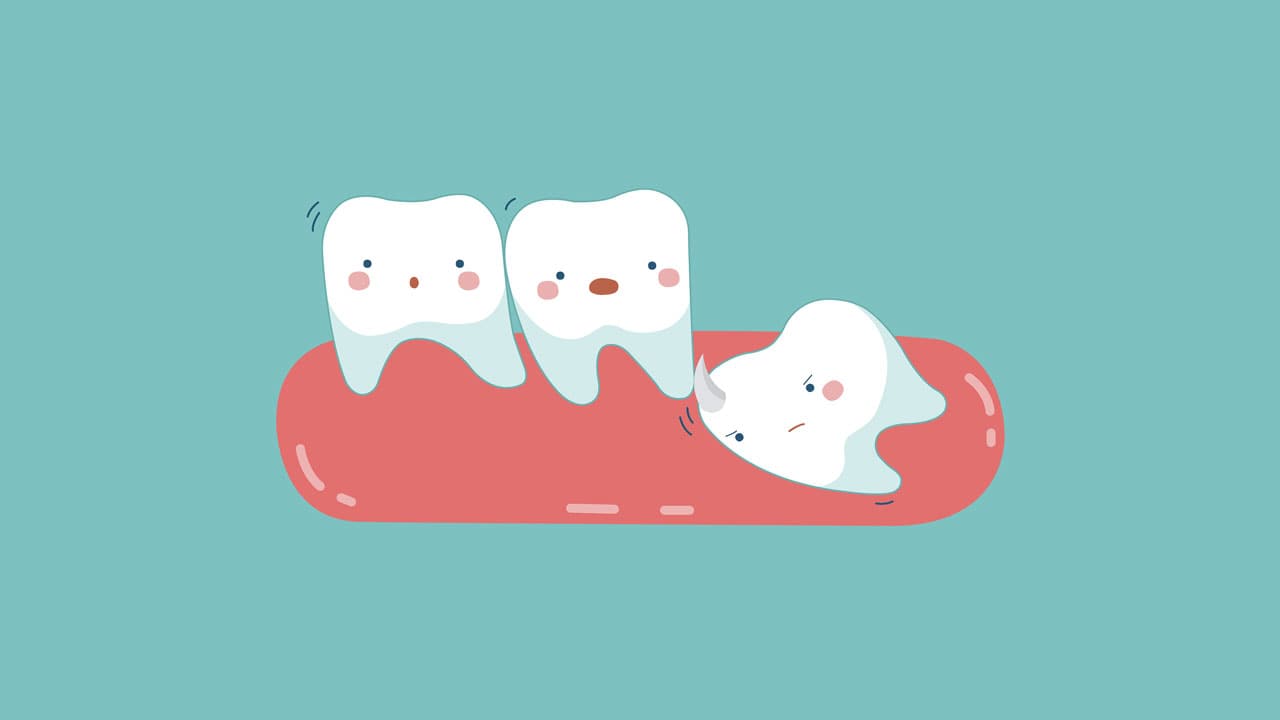 wisdom tooth cartoon