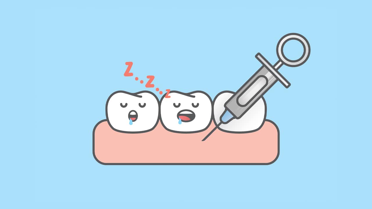 How Long Does Dental Anesthesia Last? - Caputo Dental