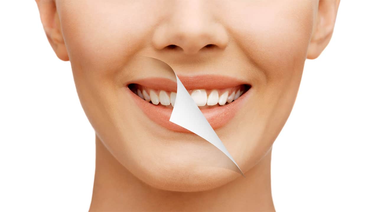 6 Cosmetic Dentistry Treatments to Improve Your Smile - Caputo Dental